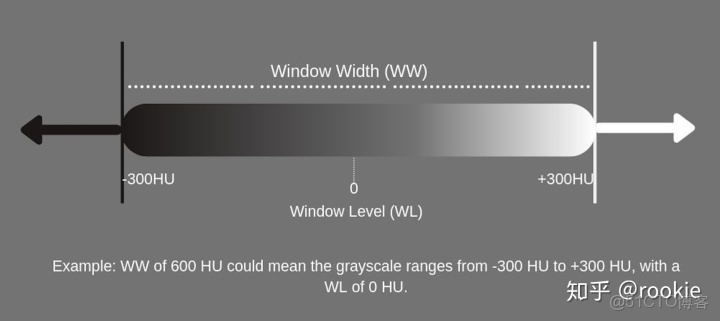 CLAHE算法增強局部對比度的X光圖像增強效果對比_#python 計算對比度_05