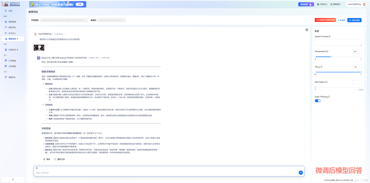 16k數據撬動300億大模型！用Qwen3-VL打造了一位“頂尖放射科醫生”_數據_02
