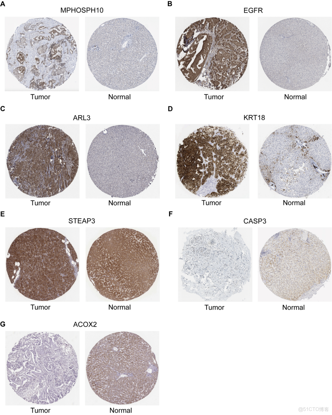 iMetaMed | 温附一夏二傑組-預測乳腺癌5年生存率-可解釋機器學習模型_#機器學習_09