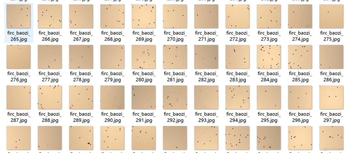 孢子檢測數據集VOC+YOLO格式522張1類別_數據集_02