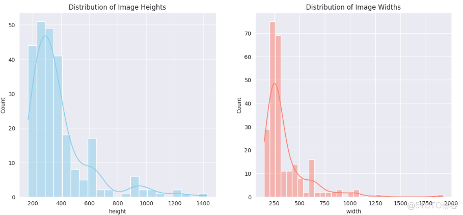 深度學習實戰-基於Vision Transformer的腦腫瘤MRI圖像識別_#人工智能_06