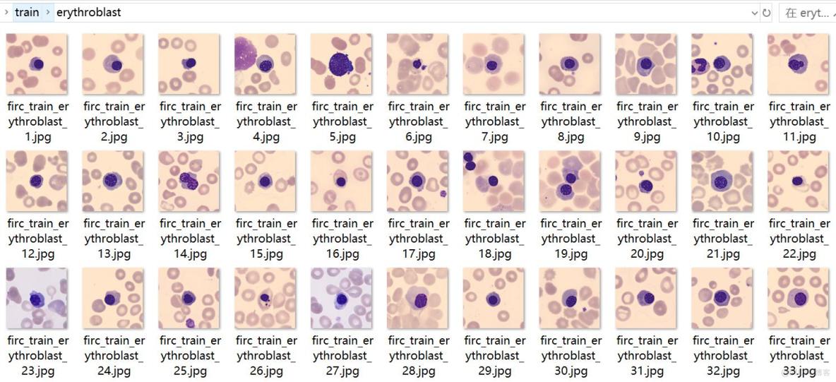 癌症檢測血細胞分類數據集499張5類別已劃分好訓練驗證測試集_數據集_02