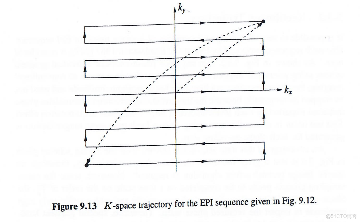 磁共振成像原理_插值_35