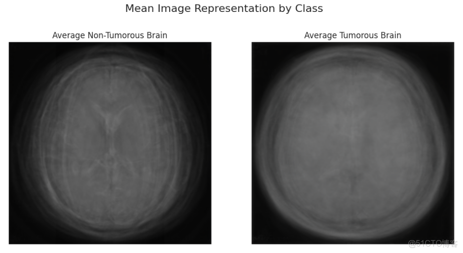 深度學習實戰-基於Vision Transformer的腦腫瘤MRI圖像識別_#transformer_07