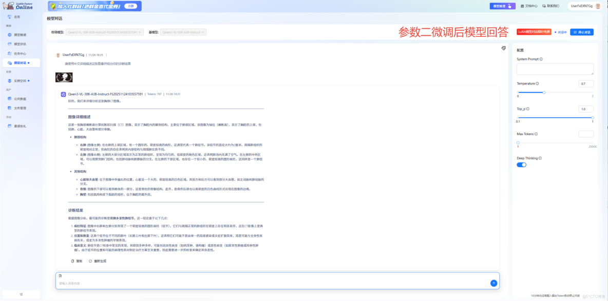 16k數據撬動300億大模型！用Qwen3-VL打造了一位“頂尖放射科醫生”_json_05