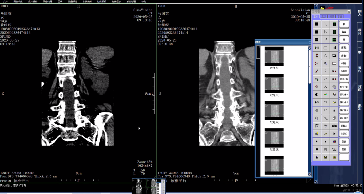 PACS系統核心技術解析：DICOM協議、分級存儲與工作流程_服務器