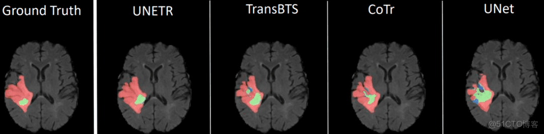 極智AI | 變形金剛大家族 Transformer ViT CLIP BLIP BERT 模型結構_51CTO博客_#人工智能_26