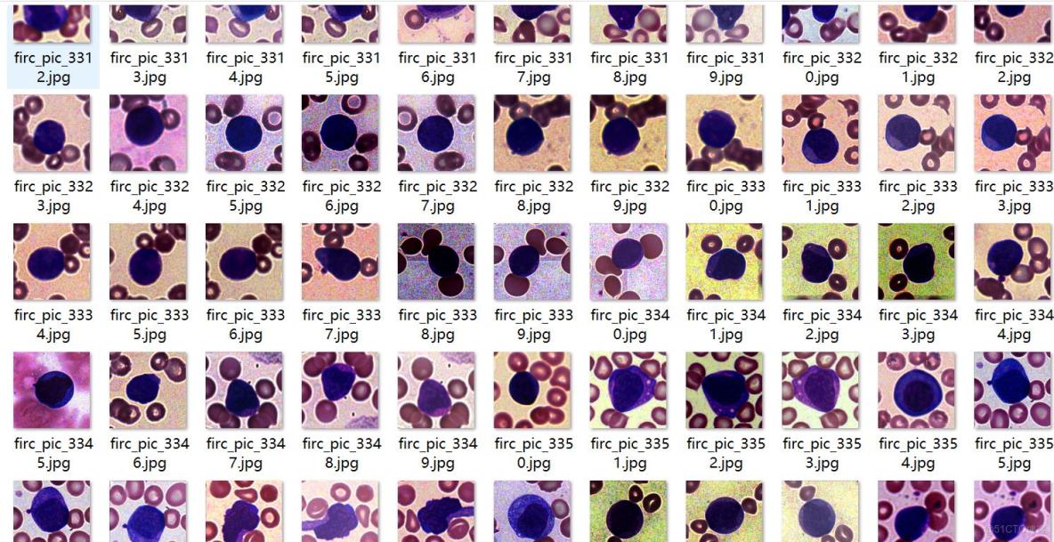 癌症檢測血細胞識別分割數據集labelme格式4918張5類別_數據集_02