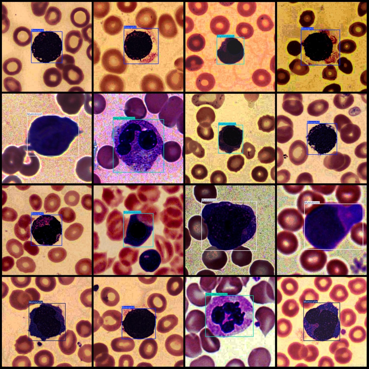 癌症檢測血細胞識別檢測數據集VOC+YOLO格式4918張5類別_數據集_03