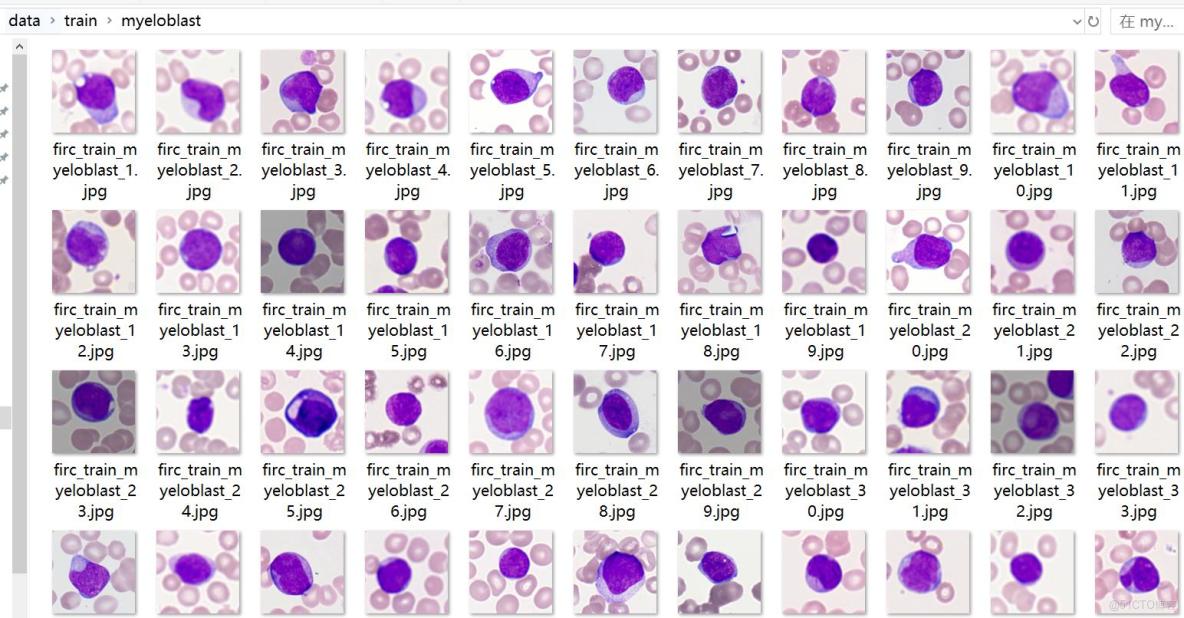 癌症檢測血細胞分類數據集499張5類別已劃分好訓練驗證測試集_目標檢測_04