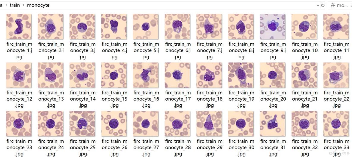 癌症檢測血細胞分類數據集499張5類別已劃分好訓練驗證測試集_目標檢測_03